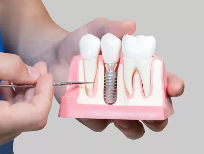 dental-implant-model-bone-cutaway-4